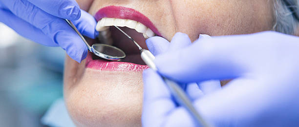 Best Dental Abscess Treatment in Frostproof, FL